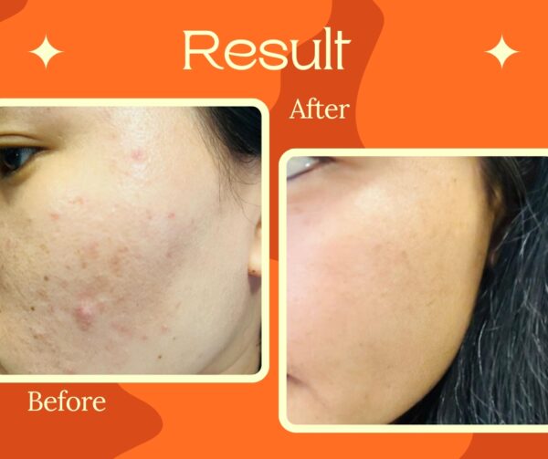Glovence Vitamin C Brightening Serum – 30ml - Image 7