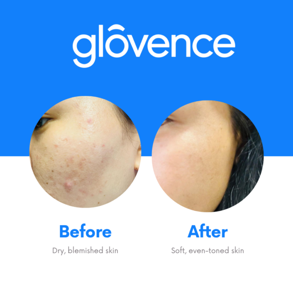 Glovence Skin Brightening Combo - Image 4